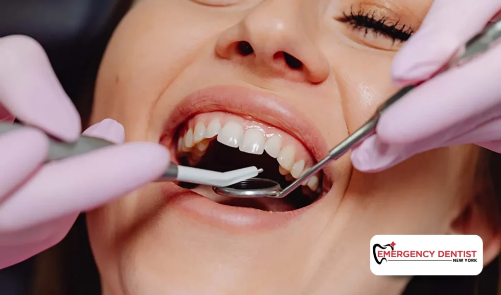 How Dentists Repair a Chipped or Broken Tooth