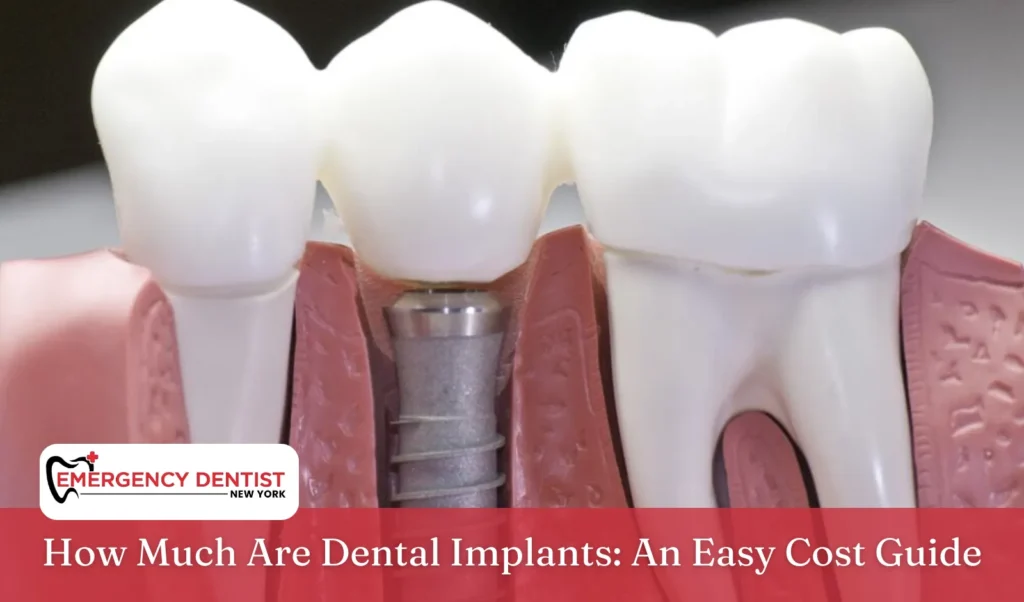 How Much Are Dental Implants An Easy Cost Guide