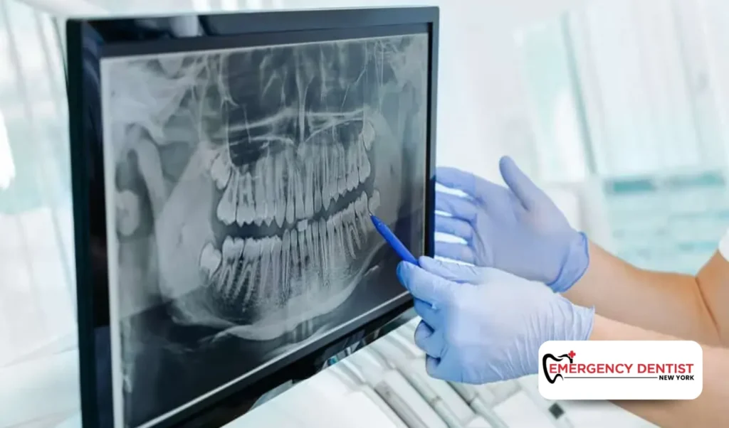 Step-by-Step Dental Implant Procedure